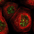 Immunofluorescent staining of human cell line A-431 shows localization to nucleoplasm & nuclear bodies.