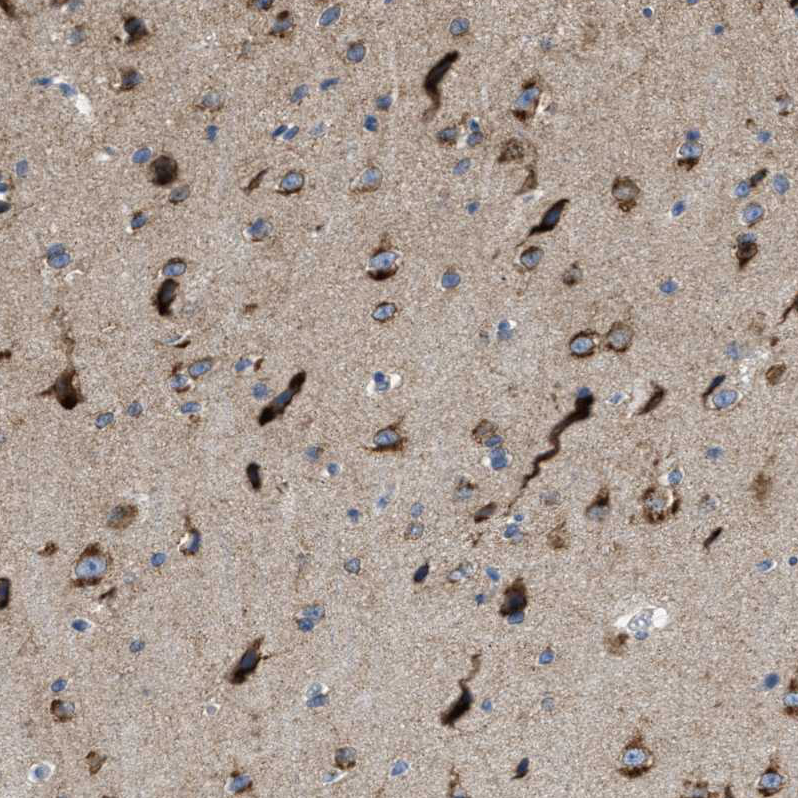 Anti-PTDSS1 Antibody