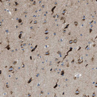 Anti-PTDSS1 Antibody