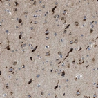 Anti-PTDSS1 Antibody