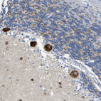 Immunohistochemical staining of human Cerebellum shows strong cytoplasmic positivity in Purkinje cells.