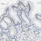 Immunohistochemical staining of human Stomach shows very weak cytoplasmic positivity in glandular cells.