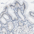 Immunohistochemical staining of human Stomach shows very weak cytoplasmic positivity in glandular cells.