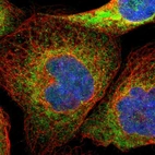 Immunofluorescent staining of human cell line A-431 shows localization to endoplasmic reticulum.