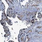 Immunohistochemical staining of human placenta shows moderate cytoplasmic positivity in endothelial cells.
