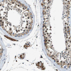 Immunohistochemical staining of human testis shows moderate cytoplasmic positivity in cells in seminiferous ducts and leydig cells.