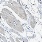 Immunohistochemical staining of human skeletal muscle shows weak positivity in myocytes.