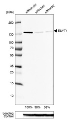 Western blot analysis in U-87MG ATCC cells transfected with control siRNA, target specific siRNA probe #1 and #2, using Anti-ESYT1 antibody. Remaining relative intensity is presented. Loading control: Anti-GAPDH.