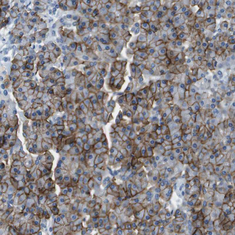 Anti-SLC16A10 Antibody