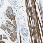 Immunohistochemical staining of human skeletal muscle shows strong cytoplasmic positivity in myocytes.