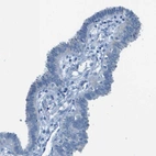 Immunohistochemical staining of human fallopian tube shows negative membranous positivity in glandular cells as expected.
