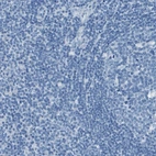 Immunohistochemical staining of human tonsil shows negative membranous positivity in non-germinal center cells and germinal center cells as expected.