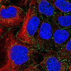 Immunofluorescent staining of human cell line CACO-2 shows localization to cell junctions & vesicles.