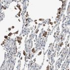Anti-SLC25A20 Antibody