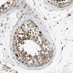 Immunohistochemical staining of human testis shows moderate cytoplasmic positivity in cells in seminiferous ducts.