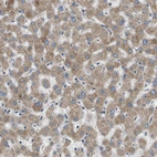 Immunohistochemical staining of human liver shows moderate cytoplasmic positivity in hepatocytes.