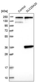Western blot analysis in control (vector only transfected HEK293T lysate) and SLC25A20 over-expression lysate (Co-expressed with a C-terminal myc-DDK tag (~3.1 kDa) in mammalian HEK293T cells, LY424755).