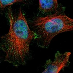 Immunofluorescent staining of human cell line U-251 MG shows localization to nucleoplasm, cytosol & cell junctions.