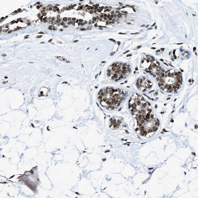 Anti-HNRNPH2 Antibody