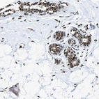 Anti-HNRNPH2 Antibody