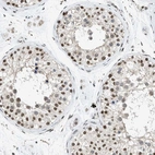 Immunohistochemical staining of human testis shows nuclear positivity.