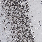 Immunohistochemical staining of human cerebellum shows nuclear positivity in cells in granular layer.