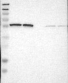 Lane 1: Marker [kDa] 230, 130, 95, 72, 56, 36, 28, 17, 11 | Lane 2: RT4 | Lane 3: U-251 MG | Lane 4: Human Plasma | Lane 5: Liver | Lane 6: Tonsil