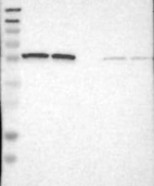 Lane 1: Marker [kDa] 230, 130, 95, 72, 56, 36, 28, 17, 11 | Lane 2: RT4 | Lane 3: U-251 MG | Lane 4: Human Plasma | Lane 5: Liver | Lane 6: Tonsil