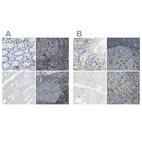 Immunohistochemical staining of human gastrointestinal, lymph node, skeletal muscle and tonsil using Anti-ITGB2 antibody HPA016894 (A) shows similar protein distribution across tissues to independent antibody HPA008877 (B).