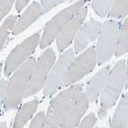 Immunohistochemical staining of human skeletal muscle shows no positivity in myocytes as expected.