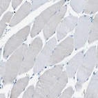 Immunohistochemical staining of human skeletal muscle shows no positivity in myocytes as expected.