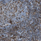 Immunohistochemical staining of human lymph node shows strong membranous positivity in germinal center cells.