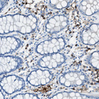 Immunohistochemical staining of human colon shows strong membranous positivity in lymphoid cells.