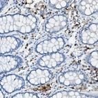 Immunohistochemical staining of human colon shows strong membranous positivity in lymphoid cells.