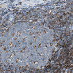 Immunohistochemical staining of human tonsil shows strong membranous positivity in germinal center cells.