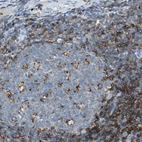 Immunohistochemical staining of human tonsil shows strong membranous positivity in germinal center cells.