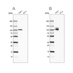 Western blot analysis using Anti-ITGB2 antibody HPA016894 (A) shows similar pattern to independent antibody HPA008877 (B).