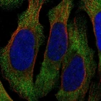 Immunofluorescent staining of human cell line U-2 OS shows localization to plasma membrane.