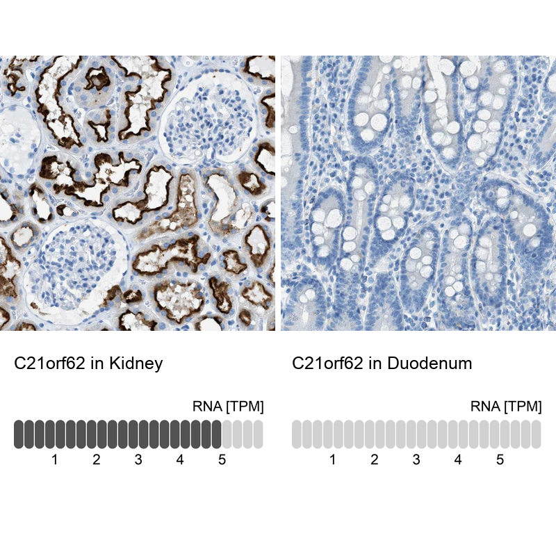 Anti-C21orf62 Antibody