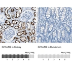 Anti-C21orf62 Antibody