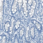 Immunohistochemical staining of human duodenum shows low expression as expected.