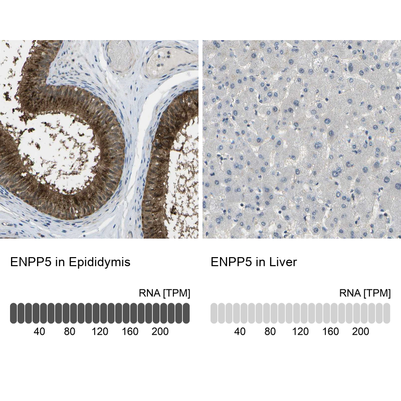 Anti-ENPP5 Antibody