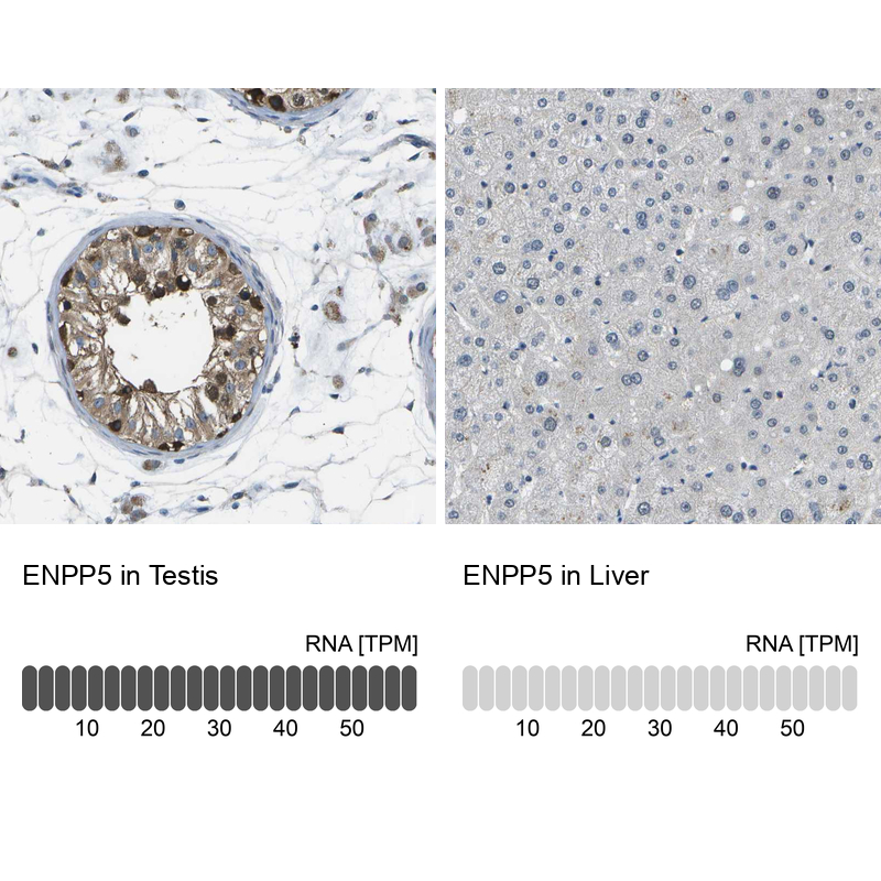 Anti-ENPP5 Antibody