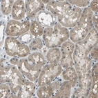 Immunohistochemical staining of human kidney shows moderate cytoplasmic/nucleus positivity in cells in tubules.