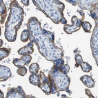 Immunohistochemical staining of human placenta shows moderate membranous positivity in trophoblastic cells.