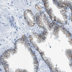 Immunohistochemical staining of human prostate shows moderate membranous positivity in glandular cells.