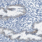Immunohistochemical staining of human endometrium shows weak membranous positivity in glandular cells.