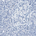 Immunohistochemical staining of human pancreas shows no positivity in a subset of exocrine glandular cells as expected.