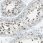 Anti-NEK11 Antibody