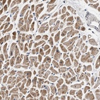 Anti-DCBLD2 Antibody